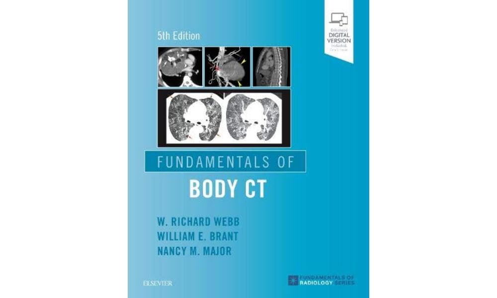 Fundamentals of Body CT baixar o livro de graça