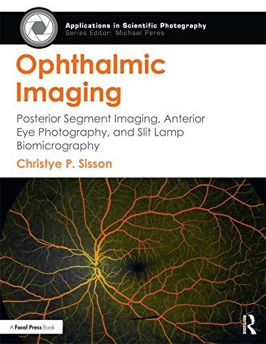 ler totalmente Ophthalmic Imaging: Posterior Segment Imaging, Anterior Eye Photography, and Slit Lamp Biomicrography (Applications in Scientific Photography) (English Edition)