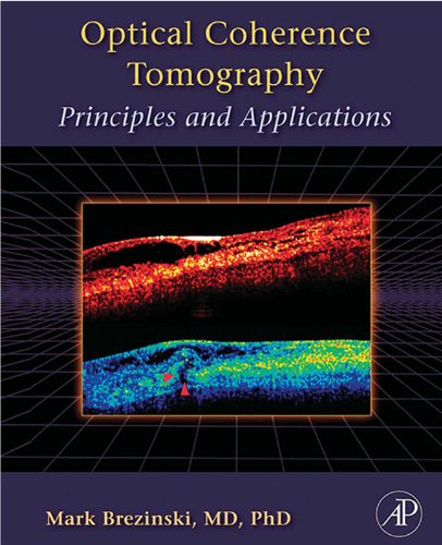 capítulo por capítulo baixar Optical Coherence Tomography: Principles and Applications (English Edition)