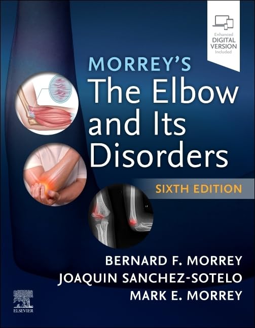 Morrey's the Elbow and Its Disorders baixar livro de graça