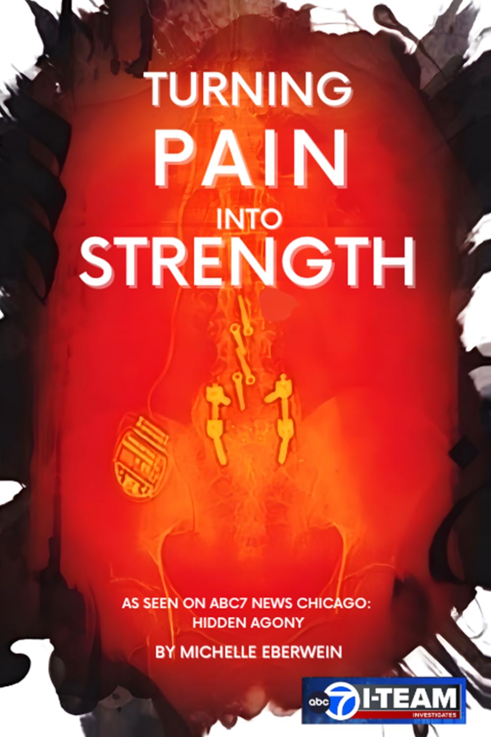 ler totalmente Turning Pain Into Strength: I made Pain my driving force.