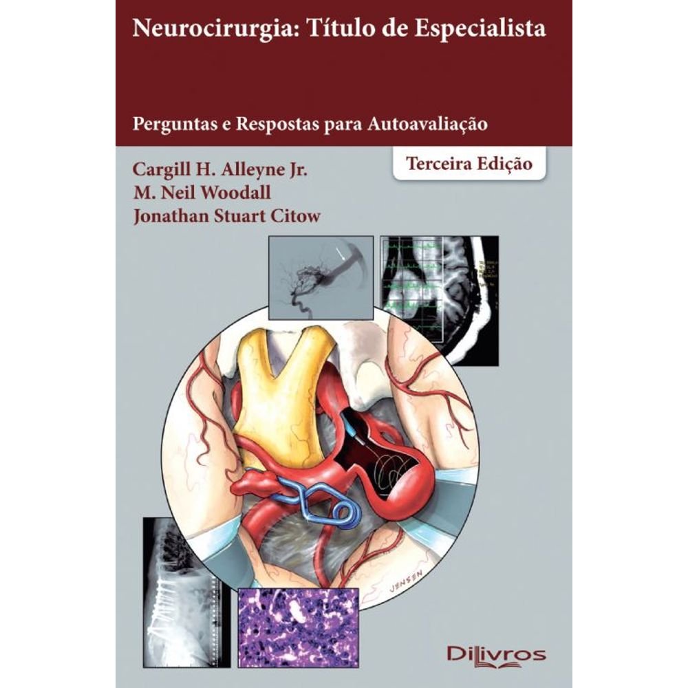 NEUROCIRURGIA TITULO DE ESPECIALISTA PERGUNTAS E RESPOSTAS PARA AUTOAVALIACÃO baixar o livro de graça