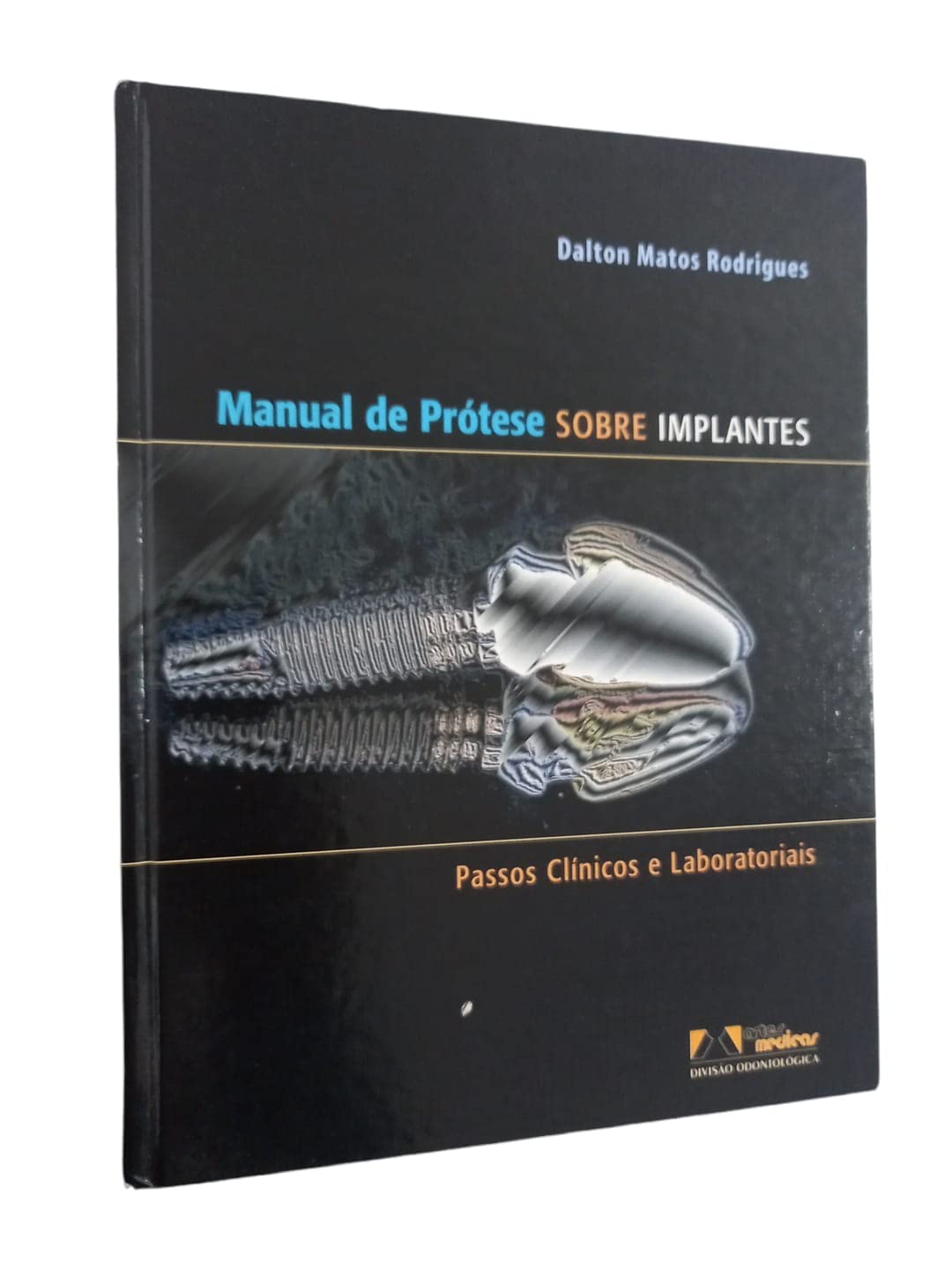 Manual De Protese Sobre Implantes baixar livro de graça