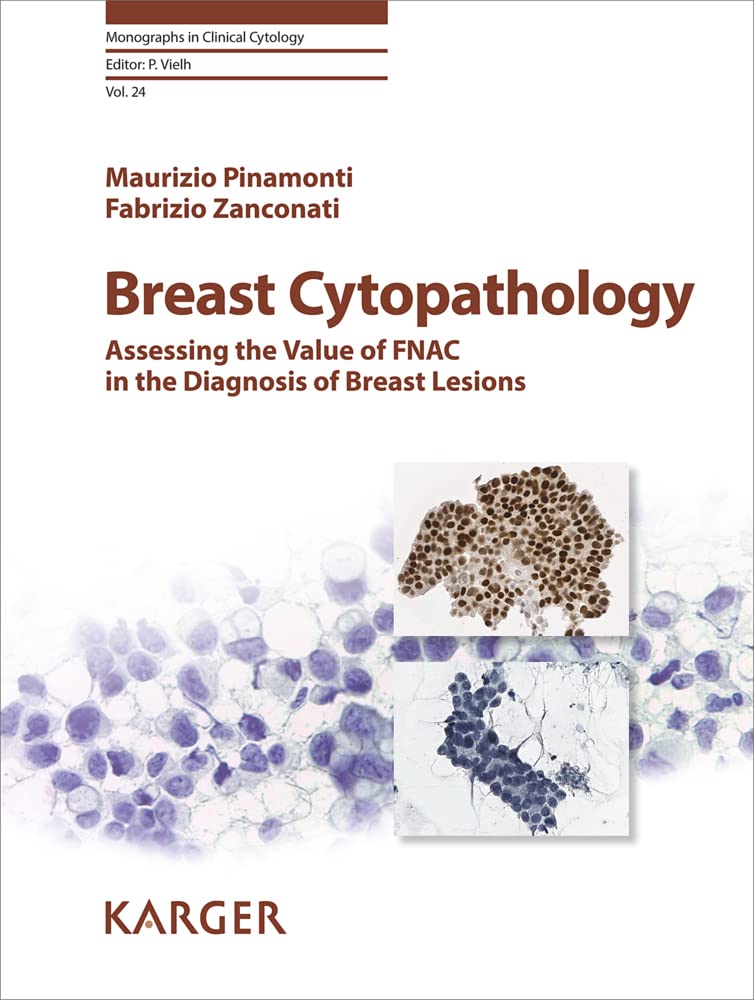 Breast Cytopathology: Assessing the Value of Fnac in the Diagnosis of Breast Lesions baixar livro de graça