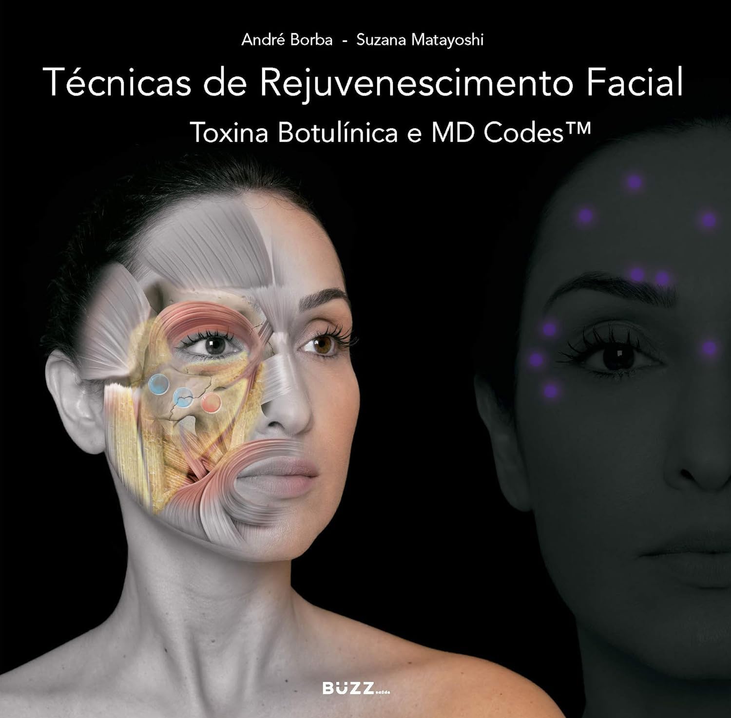 Técnicas de rejuvenescimento facial: Toxina botulínica e MD Codes baixar livro de graça