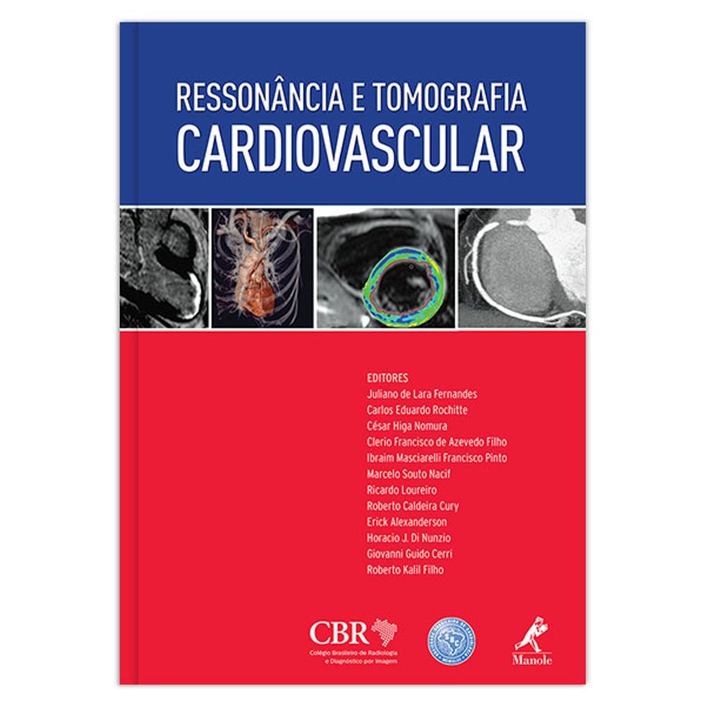 capítulo por capítulo baixar Ressonância e tomografia cardiovascular