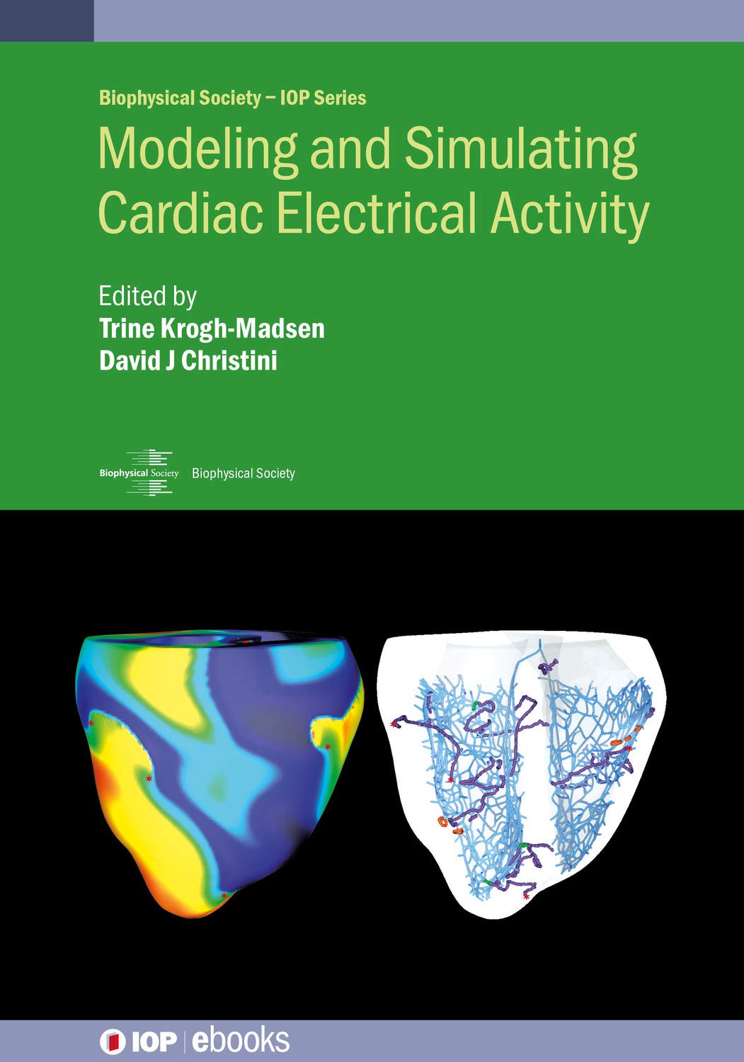 Modeling and Simulating Cardiac Electrical Activity (English Edition)