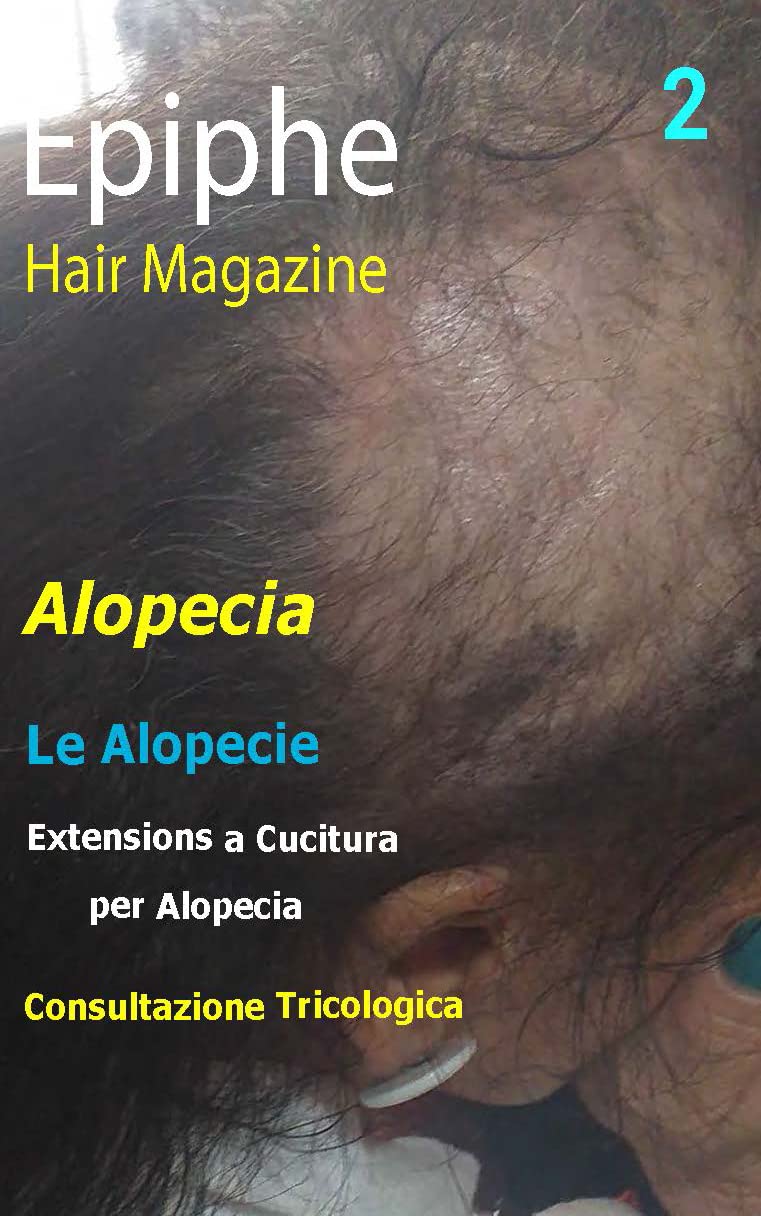 Epiphe: Alopecia (Italian Edition) baixar livro de graça