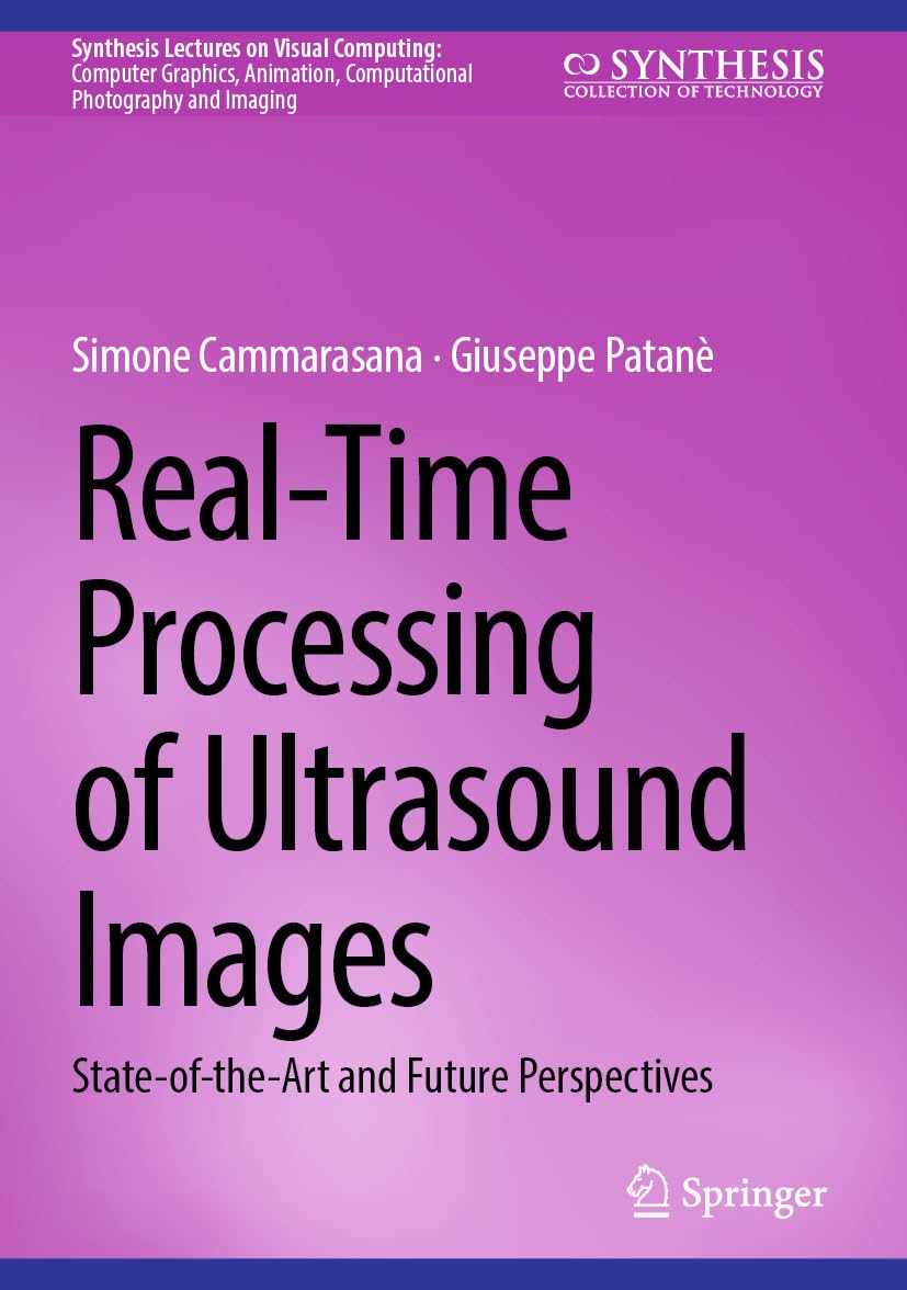 Real-Time Processing of Ultrasound Images: State-of-the-Art and Future Perspectives (Synthesis Lectures on Visual Computing: Computer Graphics, Animation,... Photography and Imaging) (English Edition) baixar o livro de graça