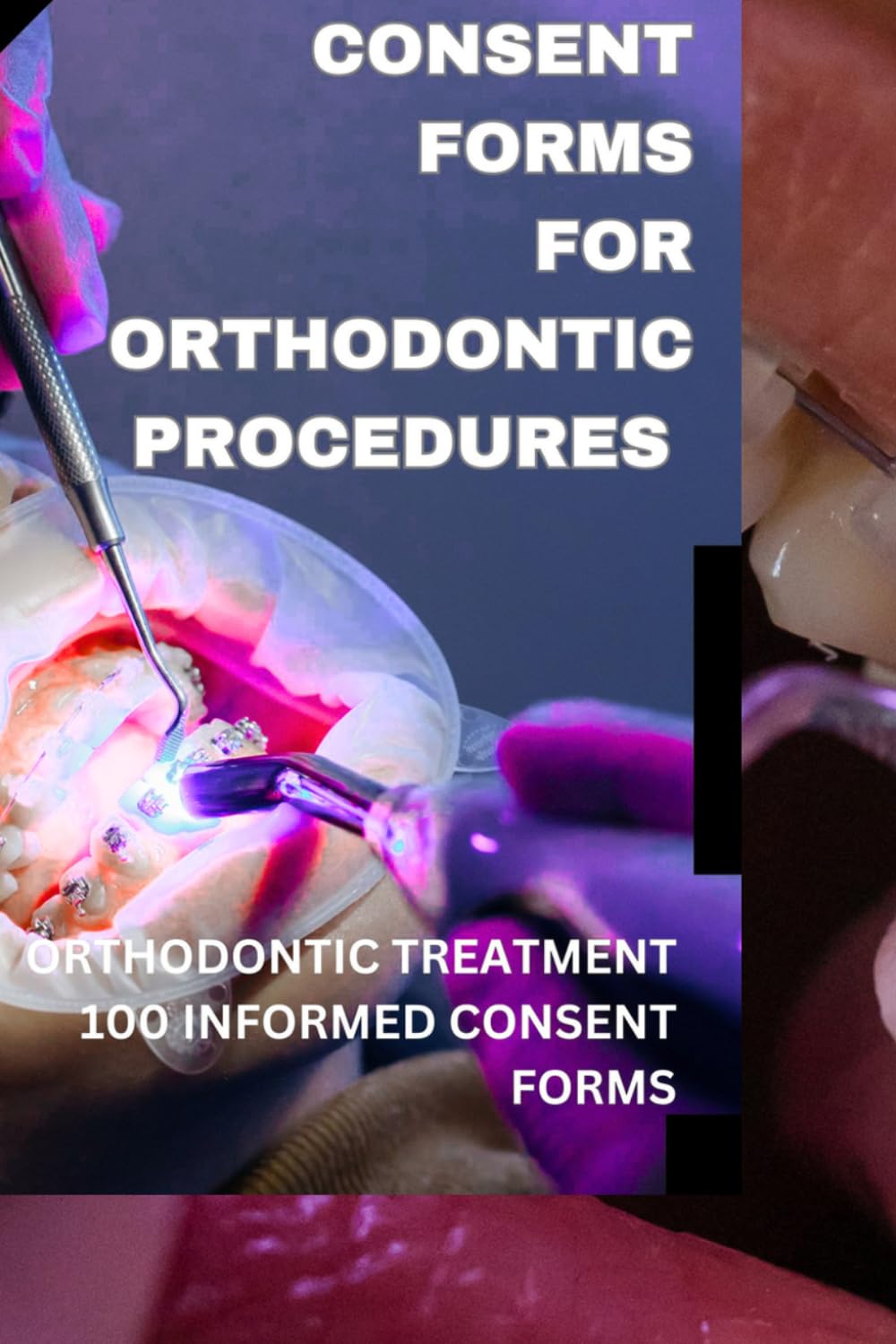Orthodontic Treatment Informed Consent forms (Dentistry Consent Forms) baixar o livro de graça
