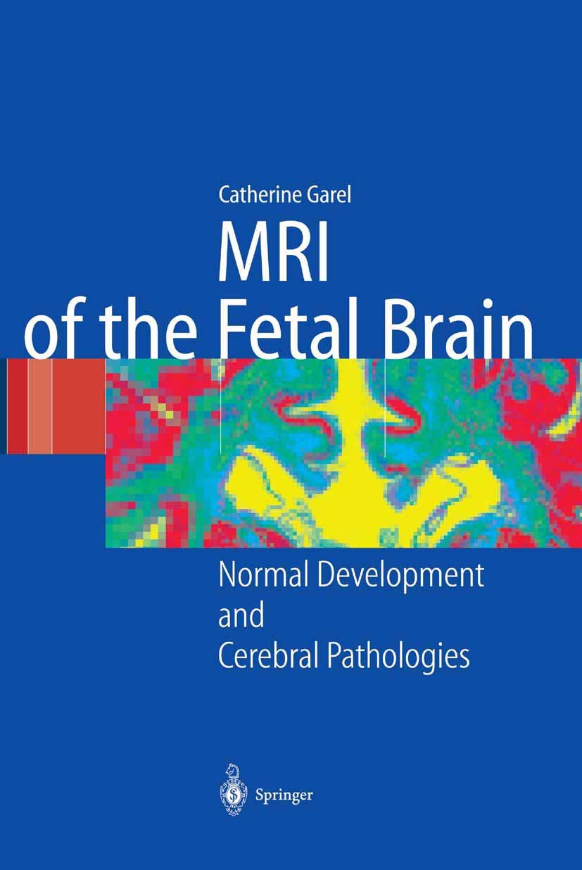 MRI of the Fetal Brain: Normal Development and Cerebral Pathologies baixar livro de graça