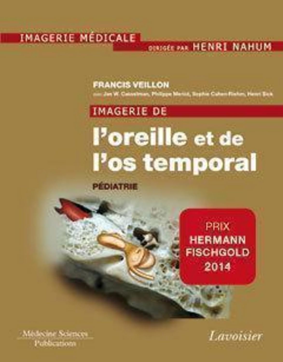 Imagerie de l'oreille et de l'os temporal: Volume 5. Pédiatrie (French Edition) baixar livro de graça