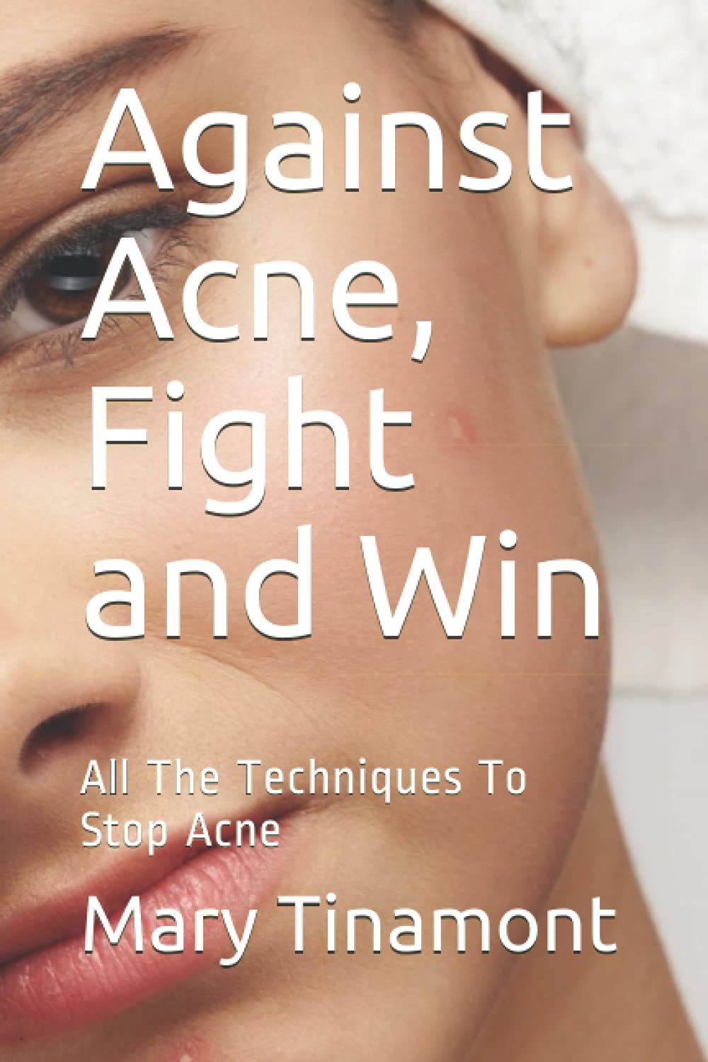 capítulo por capítulo baixar Against Acne, Fight and Win: All The Techniques To Stop Acne