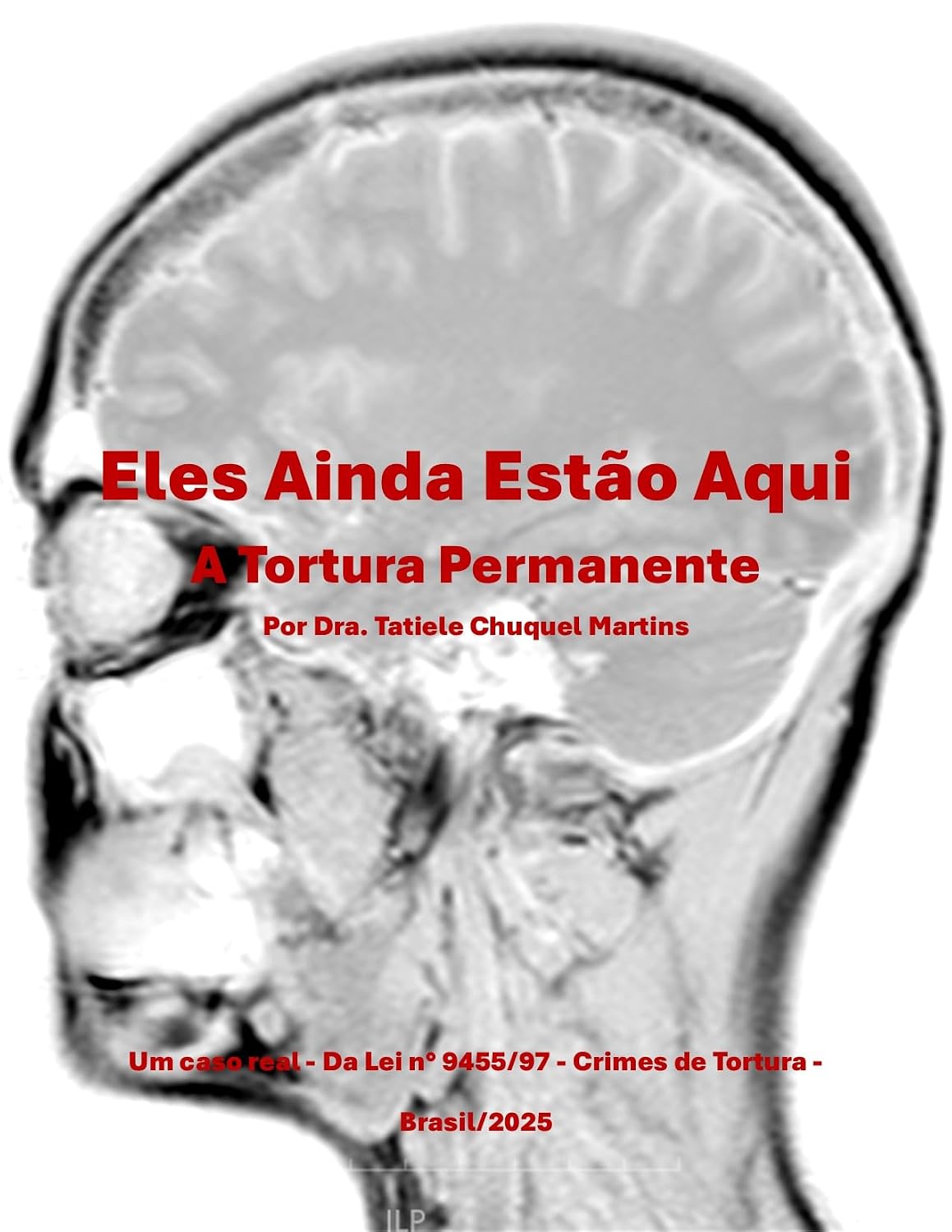 ELES AINDA ESTÃO AQUI A tortura permanente: Da Lei n°9455/97 Crimes de tortura baixar livro de graça