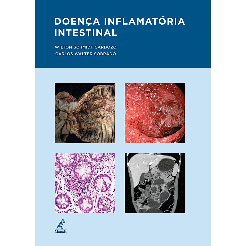 capítulo por capítulo baixar Doença inflamatória intestinal