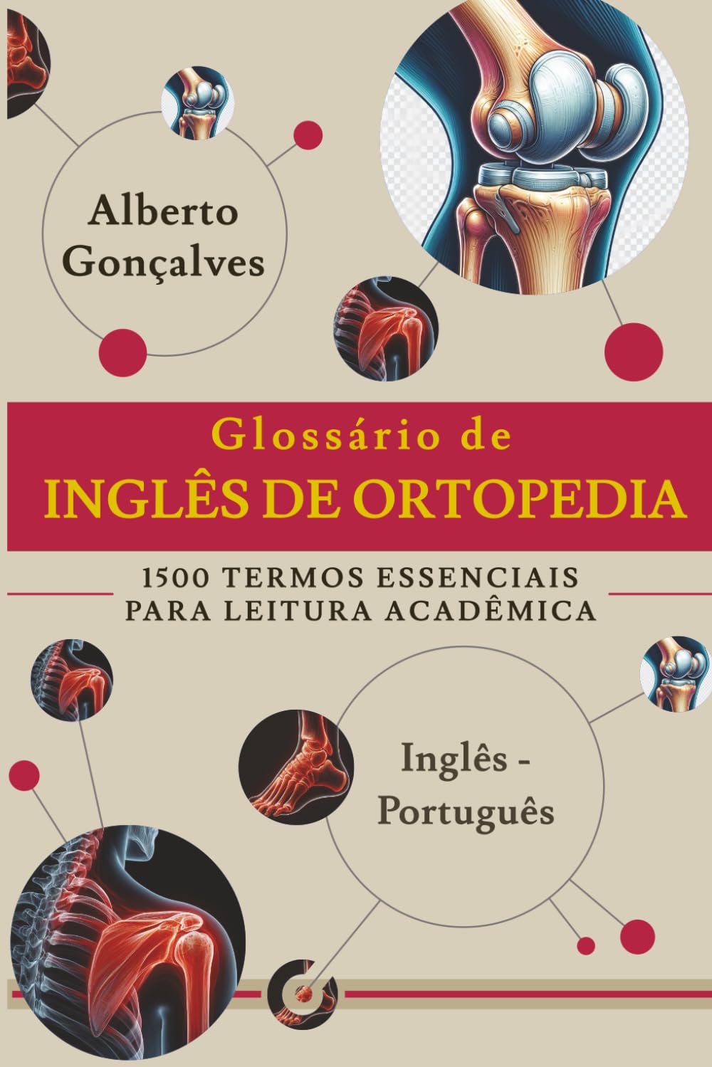 ler totalmente Glossário de Inglês de Ortopedia: 1500 Termos essenciais para Leitura Acadêmica Inglês-Português (Portuguese Edition)