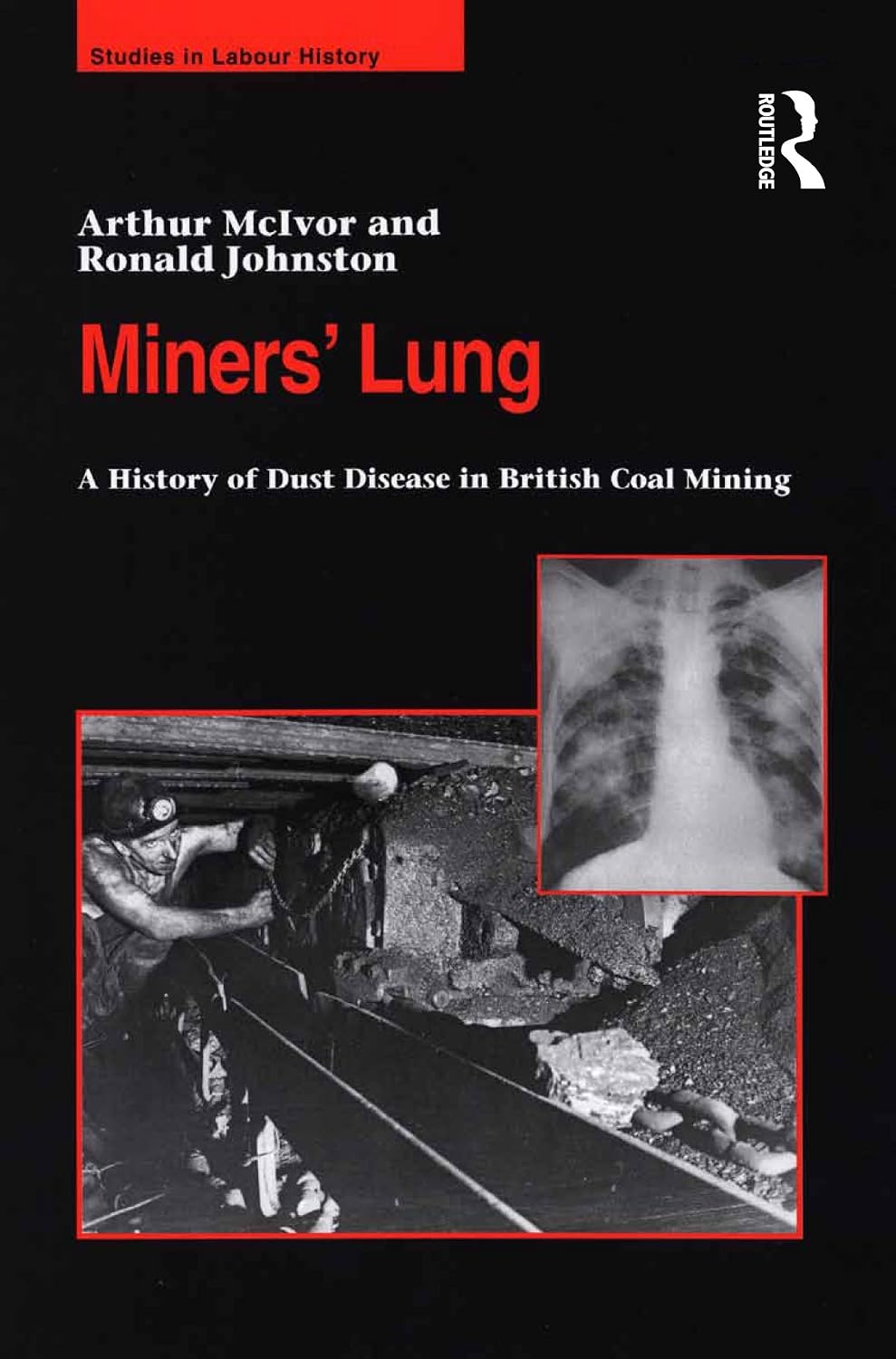 ler totalmente Miners' Lung: A History of Dust Disease in British Coal Mining (English Edition)