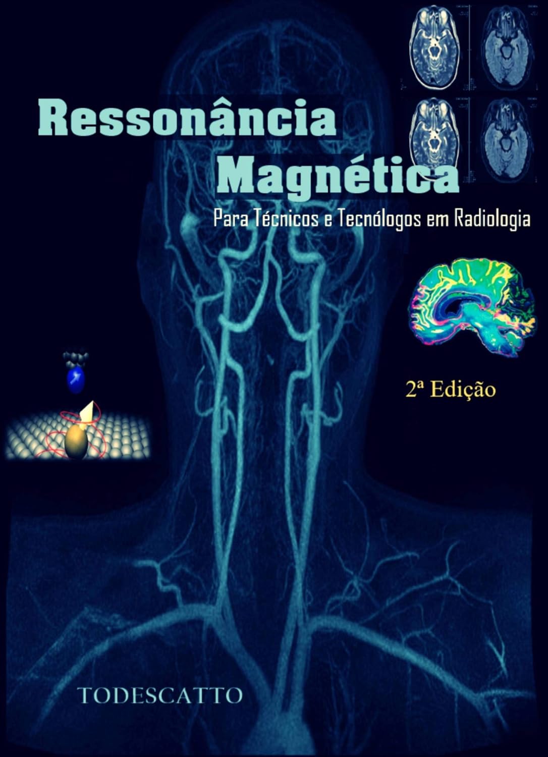 Livro de Ressonância Magnética: Para Estudantes e Profissionais da Radiologia (1) baixar livro de graça
