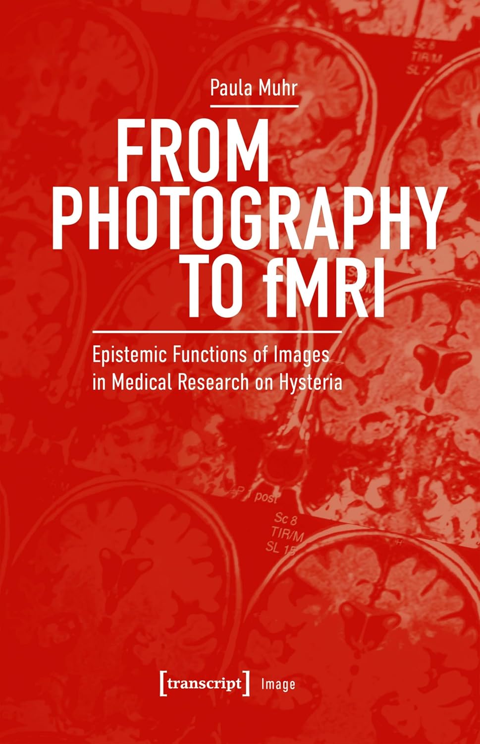 From Photography to fMRI: Epistemic Functions of Images in Medical Research on Hysteria (English Edition)