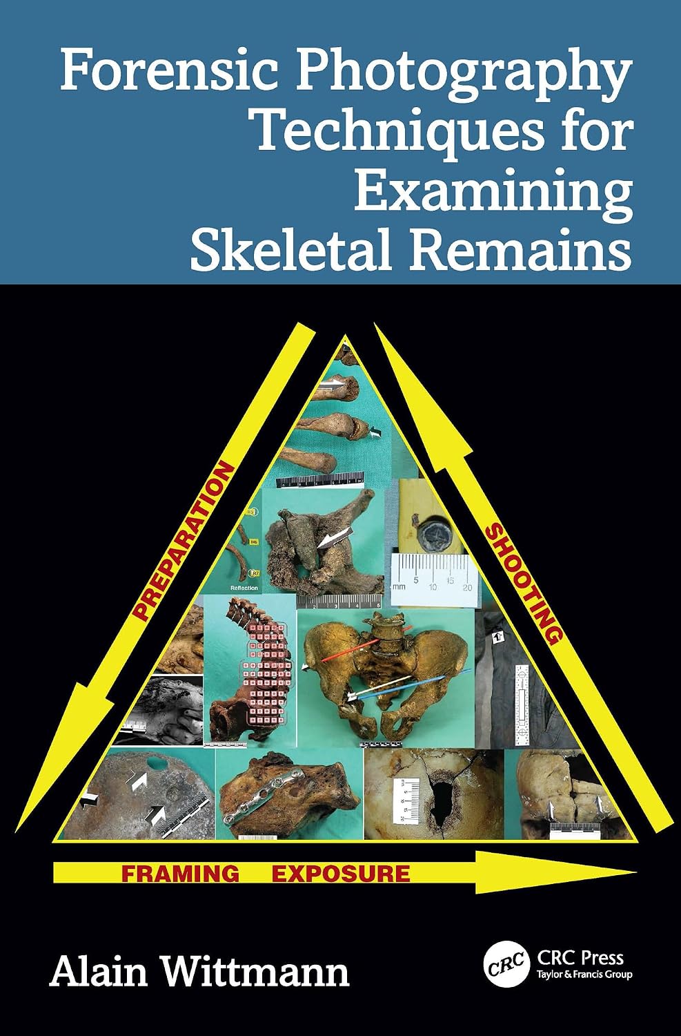 Forensic Photography Techniques for Examining Skeletal Remains (English Edition) baixar livro de graça