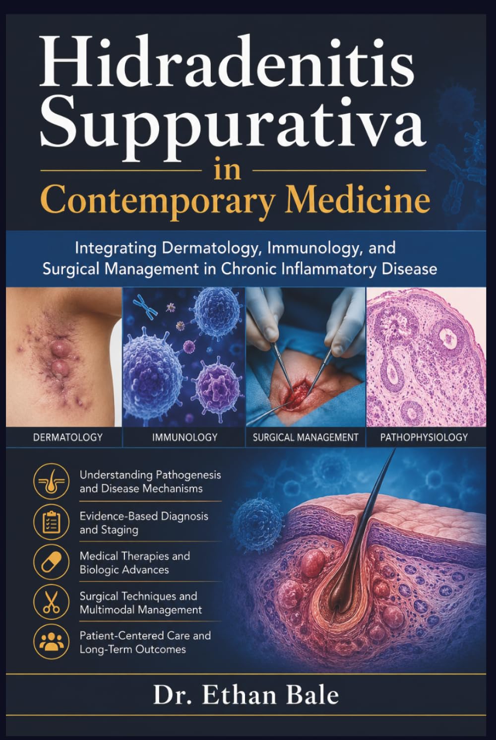 capítulo por capítulo baixar Hidradenitis Suppurativa in Contemporary Medicine: Integrating Dermatology, Immunology, and Surgical Management in Chronic Inflammatory Disease