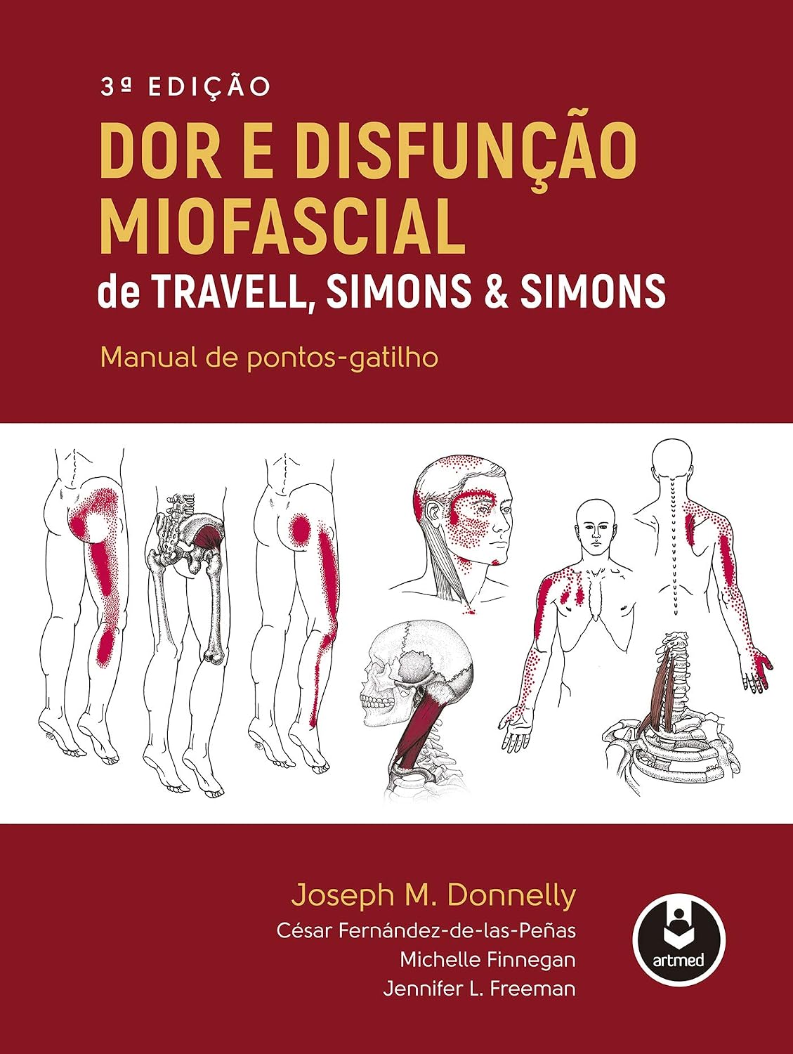 Dor e Disfunção Miofascial de Travell, Simons & Simons: Manual de Pontos-Gatilho baixar livro de graça