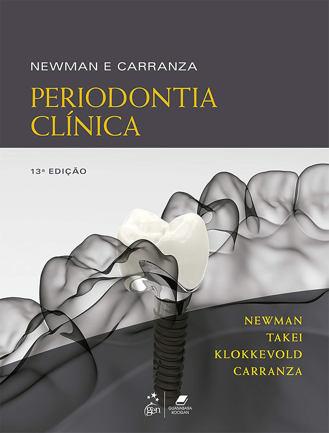 Newman e Carranza: Periodontia Clínica baixar livro de graça