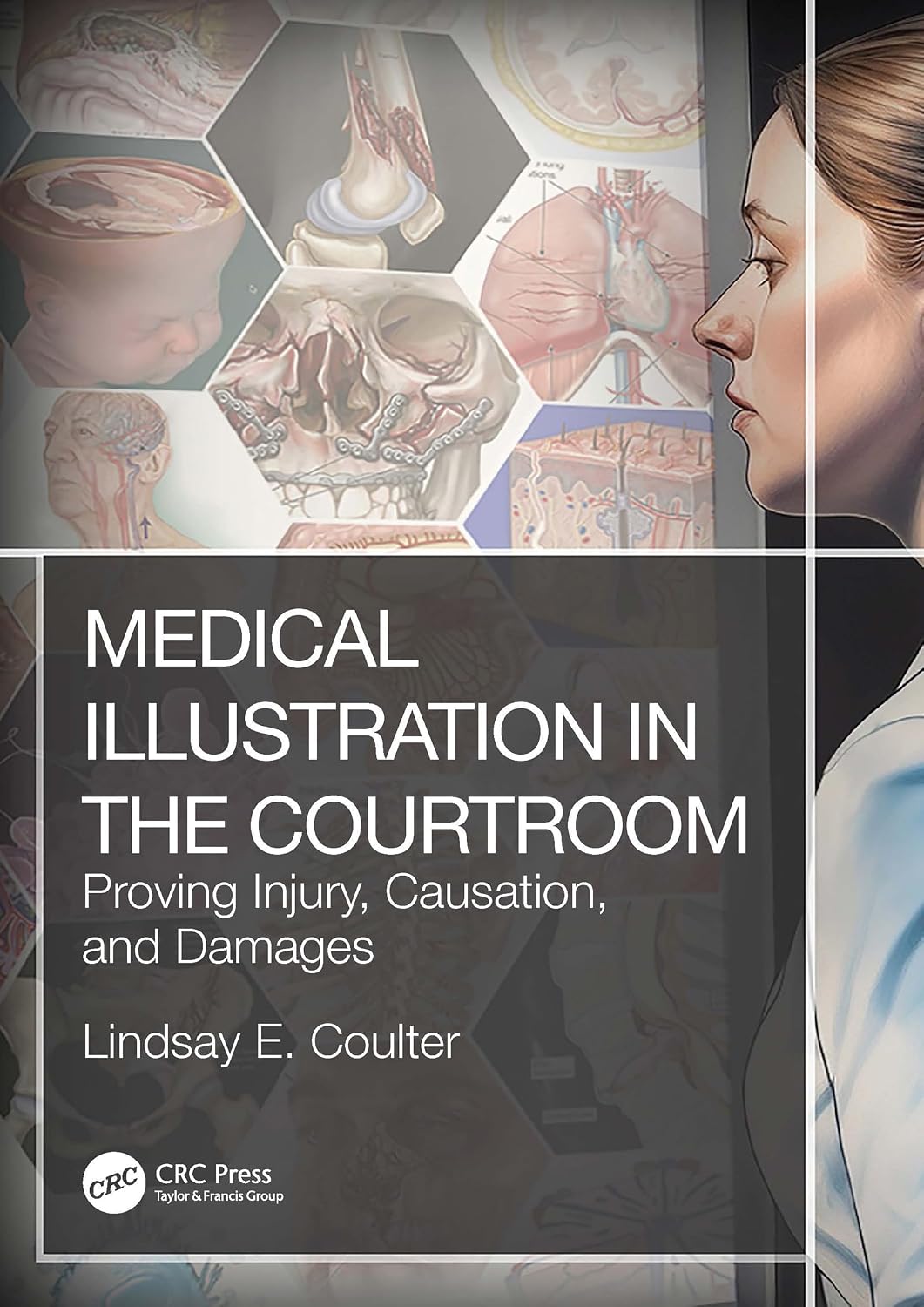 Medical Illustration in the Courtroom: Proving Injury, Causation, and Damages (English Edition) baixar livro de graça