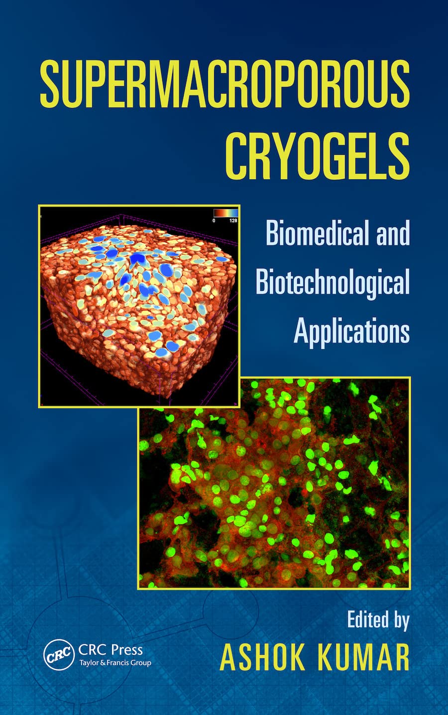 Supermacroporous Cryogels: Biomedical and Biotechnological Applications (English Edition) baixar o livro de graça