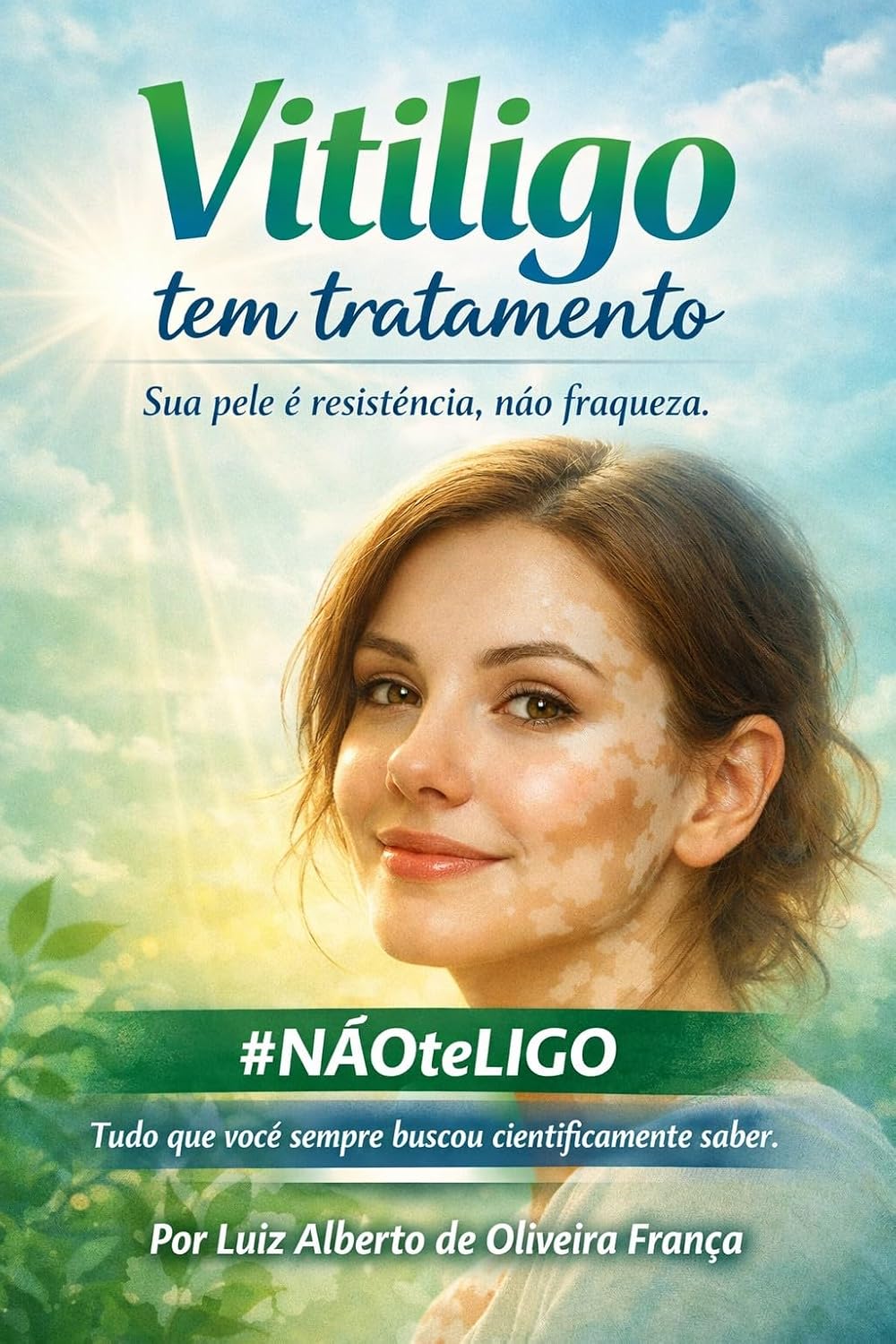 VITILIGO TEM TRATAMENTO: #NãoTeLigo É resistência ao Estigma baixar o livro de graça