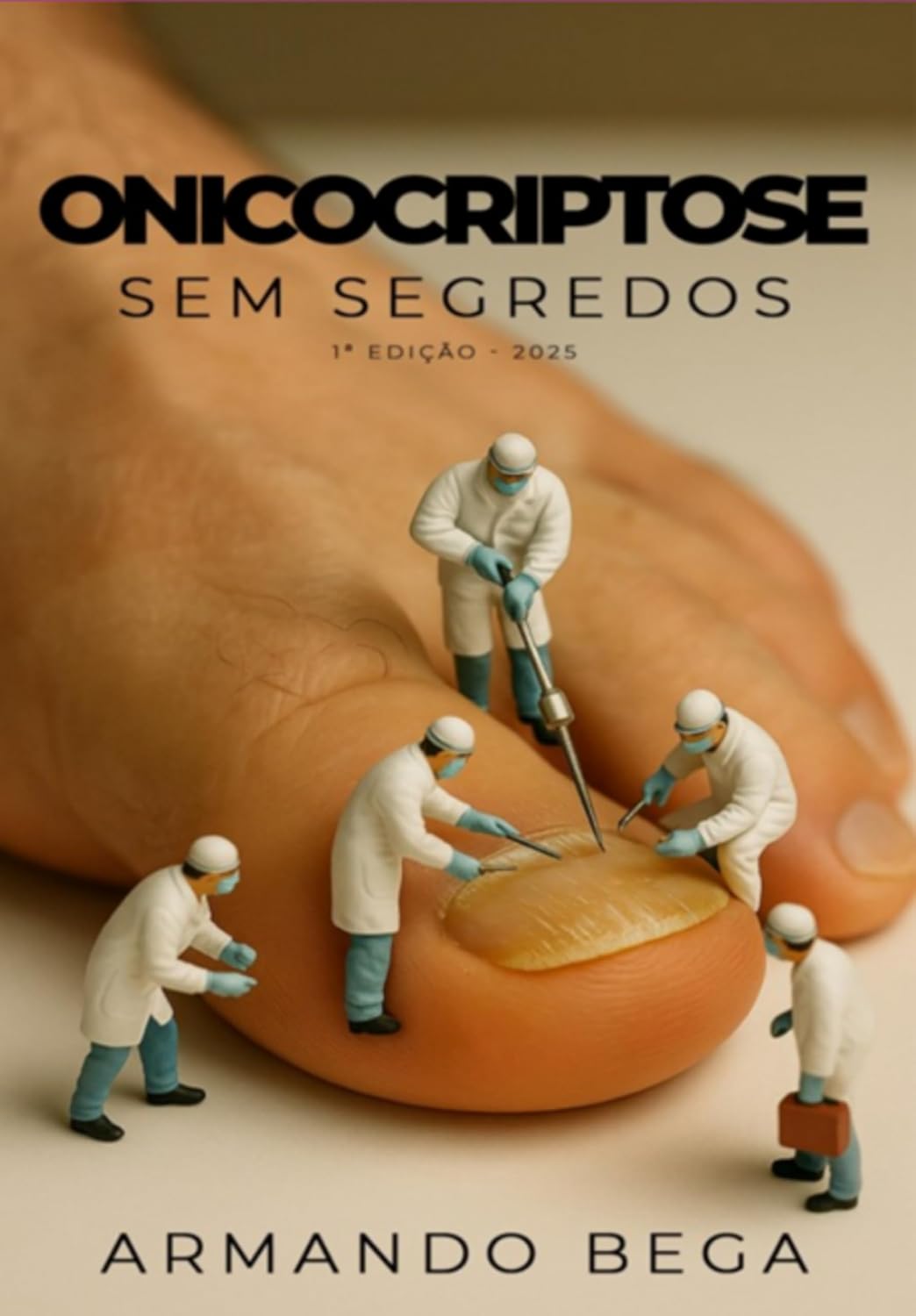 ler totalmente Onicocriptose Sem Segredos