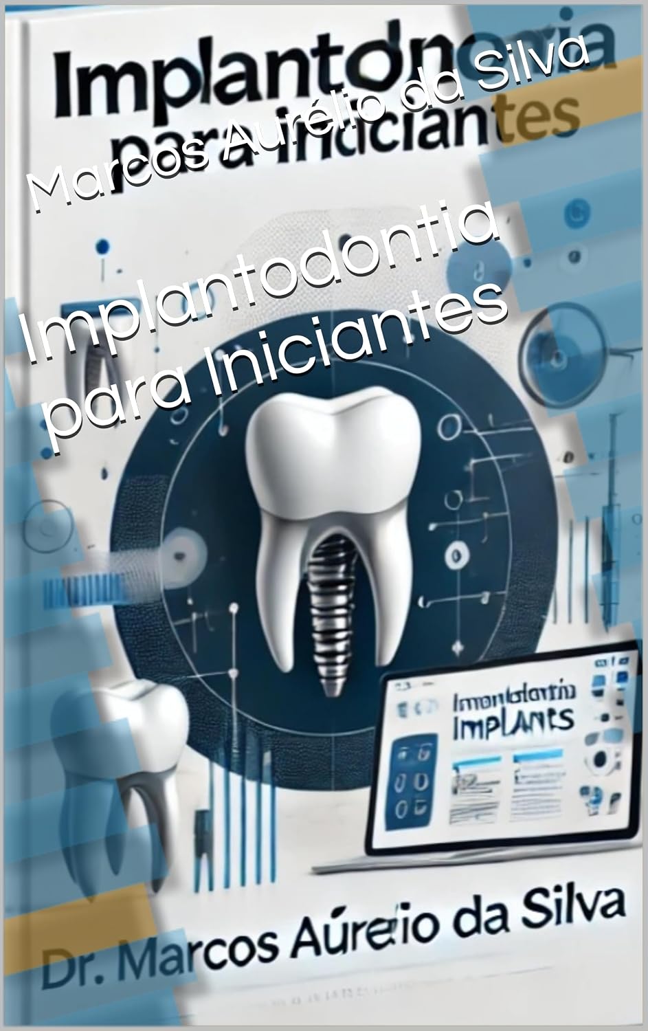 capítulo por capítulo baixar Implantodontia para Iniciantes