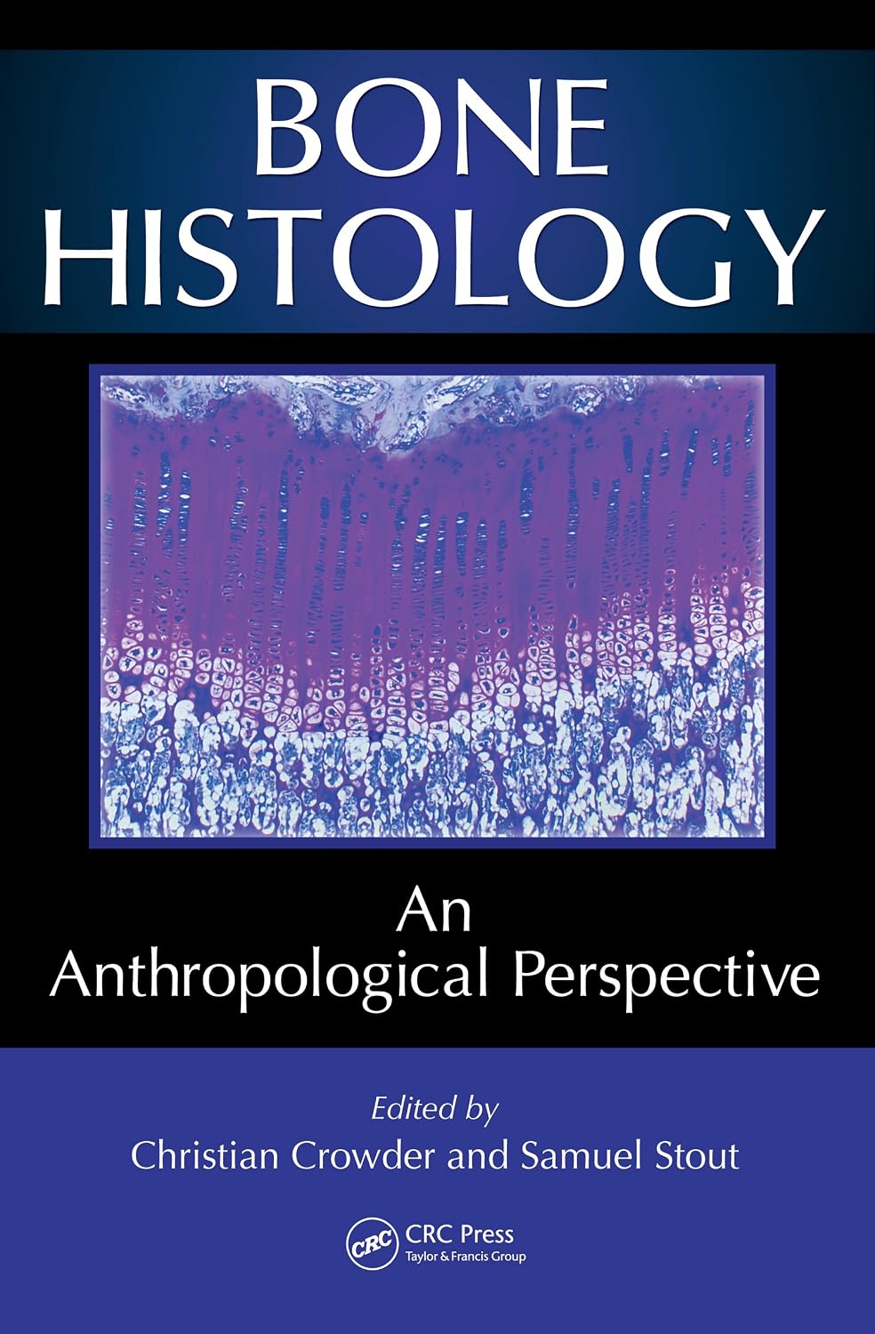 Bone Histology: An Anthropological Perspective (English Edition) baixar o livro de graça