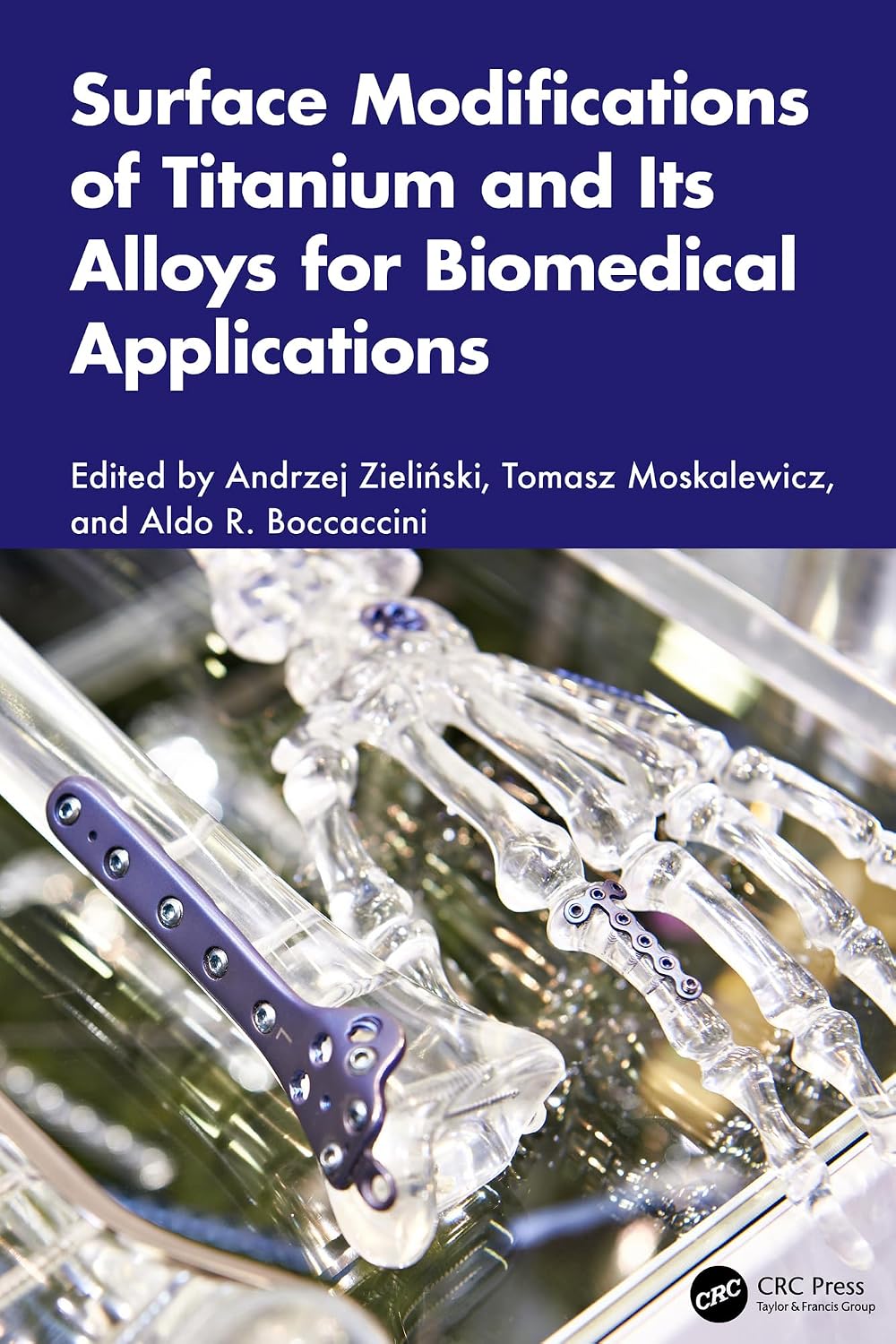 Surface Modifications of Titanium and Its Alloys for Biomedical Applications (English Edition)