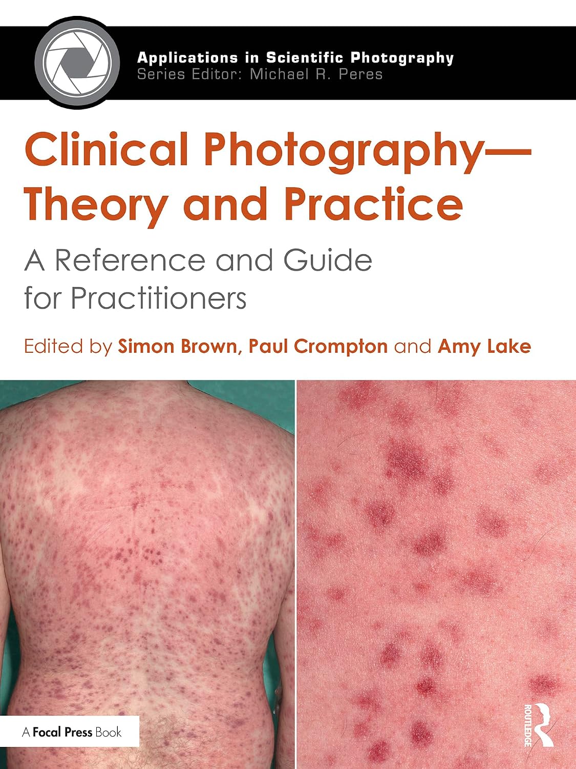 Clinical Photography — Theory and Practice: A Reference and Guide for Practitioners (Applications in Scientific Photography) (English Edition) baixar o livro de graça