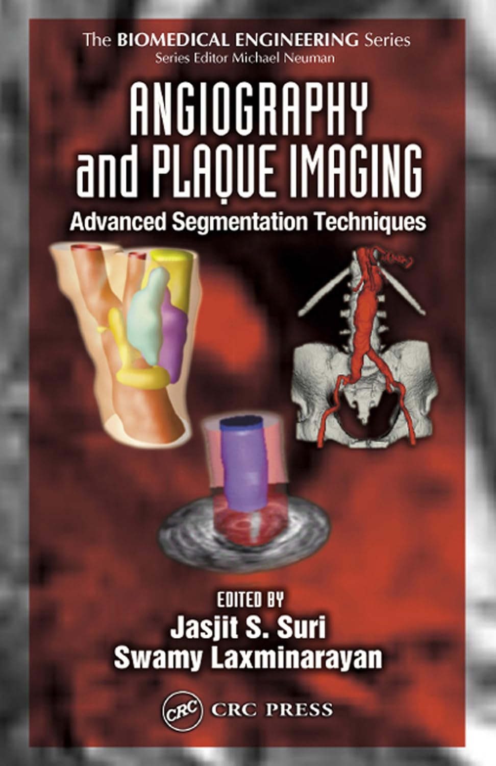 Angiography and Plaque Imaging: Advanced Segmentation Techniques (Biomedical Engineering) (English Edition) baixar livro de graça