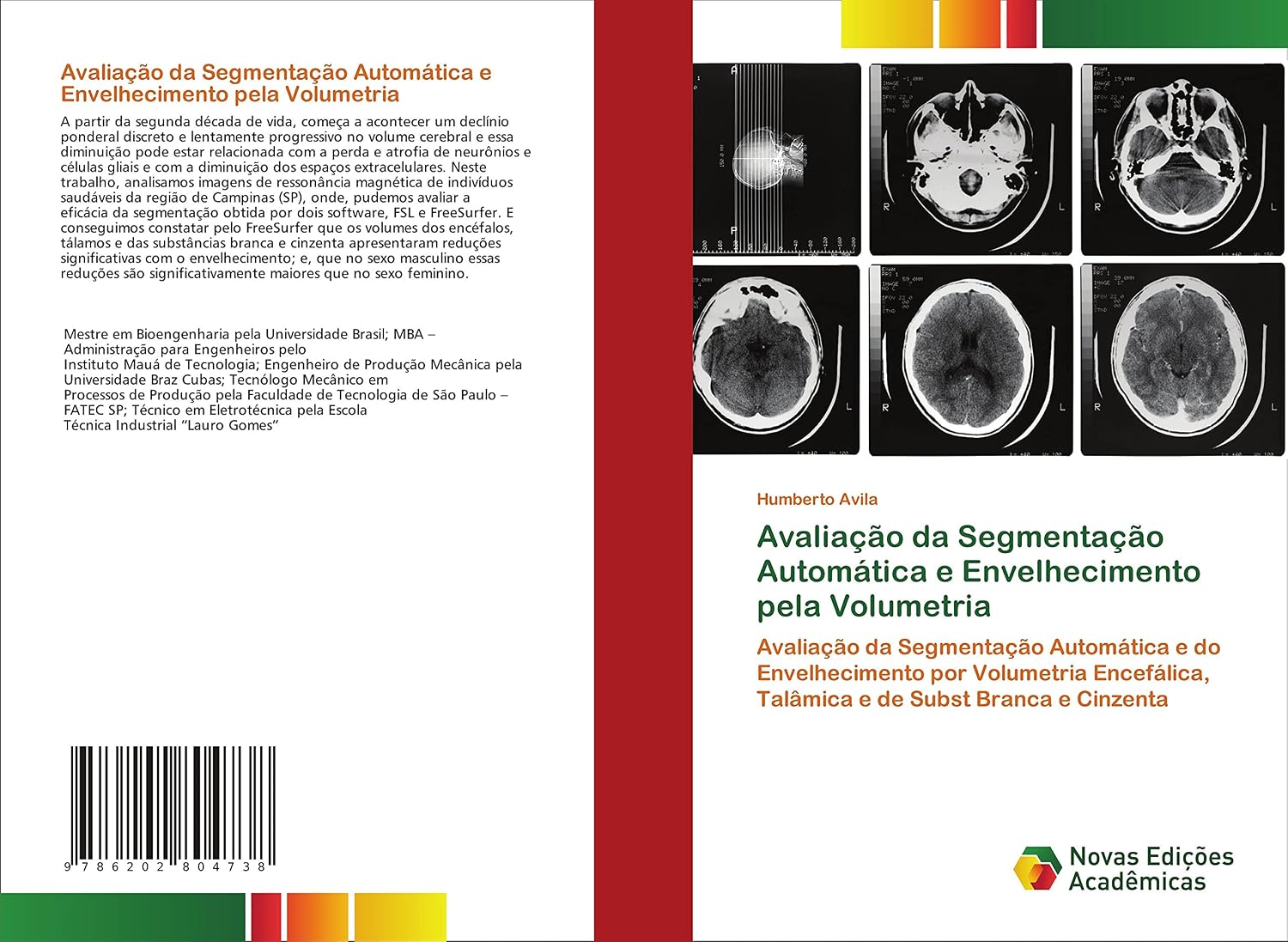 ler totalmente Avaliação da Segmentação Automática e Envelhecimento pela Volumetria: Avaliação da Segmentação Automática e do Envelhecimento por Volumetria Encefálica, Talâmica e de Subst Branca e Cinzenta