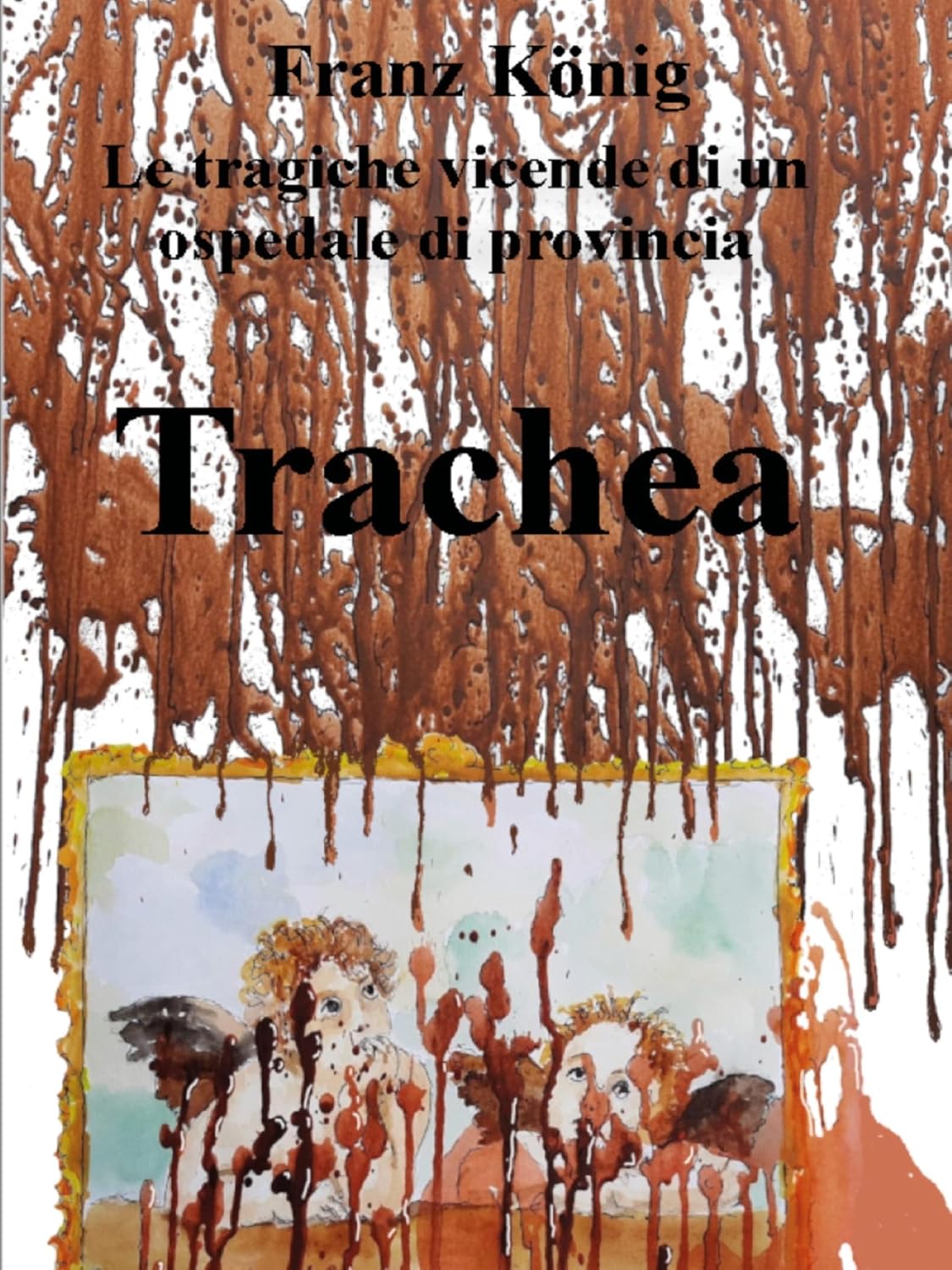 ler totalmente Trachea. Le tragiche vicende di un ospedale di provincia (Italian Edition)