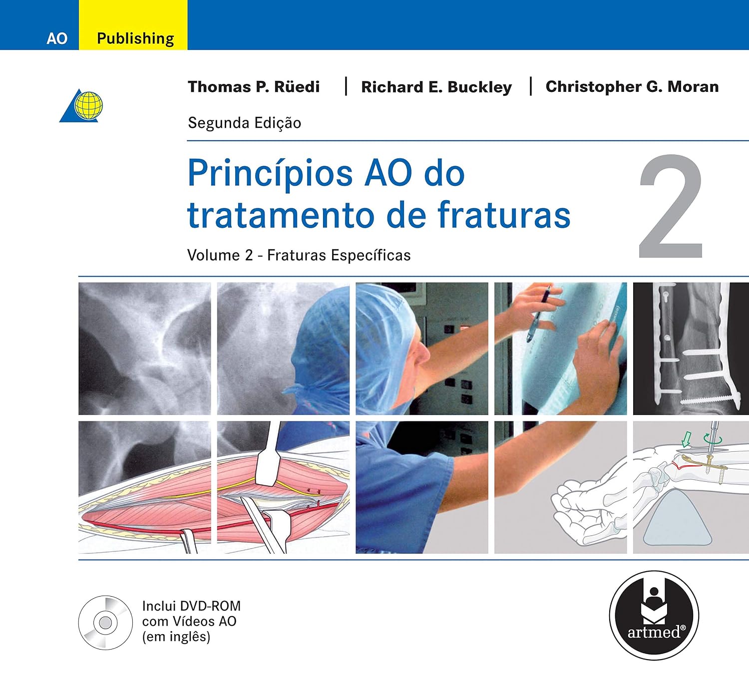 Princípios AO do Tratamento de Fraturas baixar livro de graça