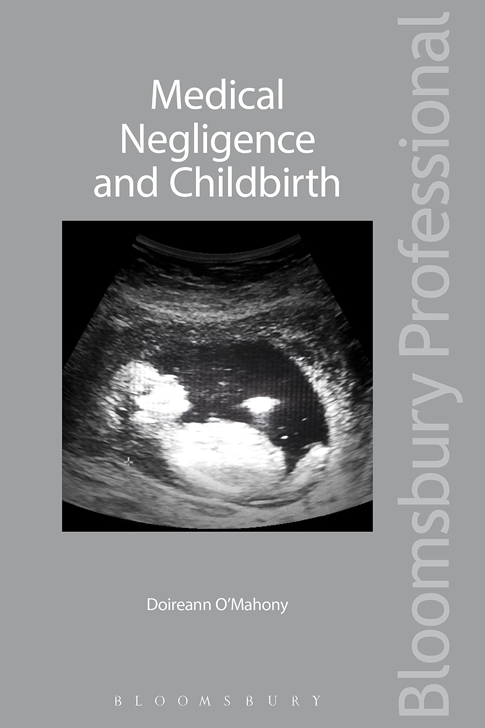 Medical Negligence and Childbirth (English Edition) baixar livro de graça