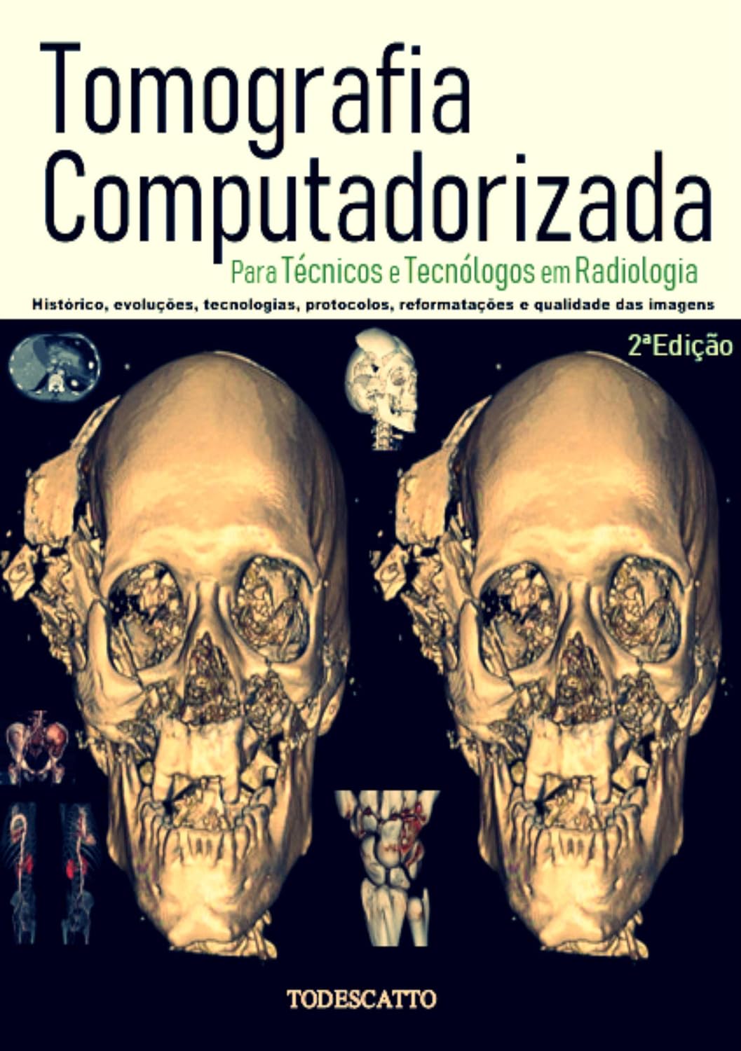 ler totalmente Tomografia Computadorizada: Para Técnicos e Tecnólogos em Radiologia (1)