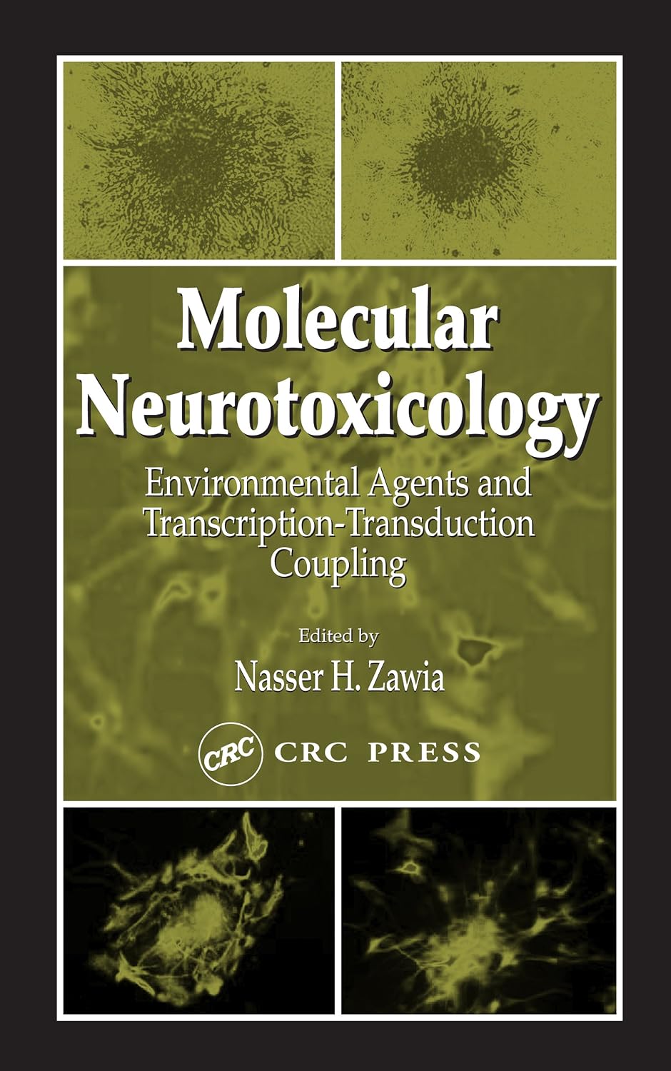 ler totalmente Molecular Neurotoxicology: Environmental Agents and Transcription-Transduction Coupling (English Edition)