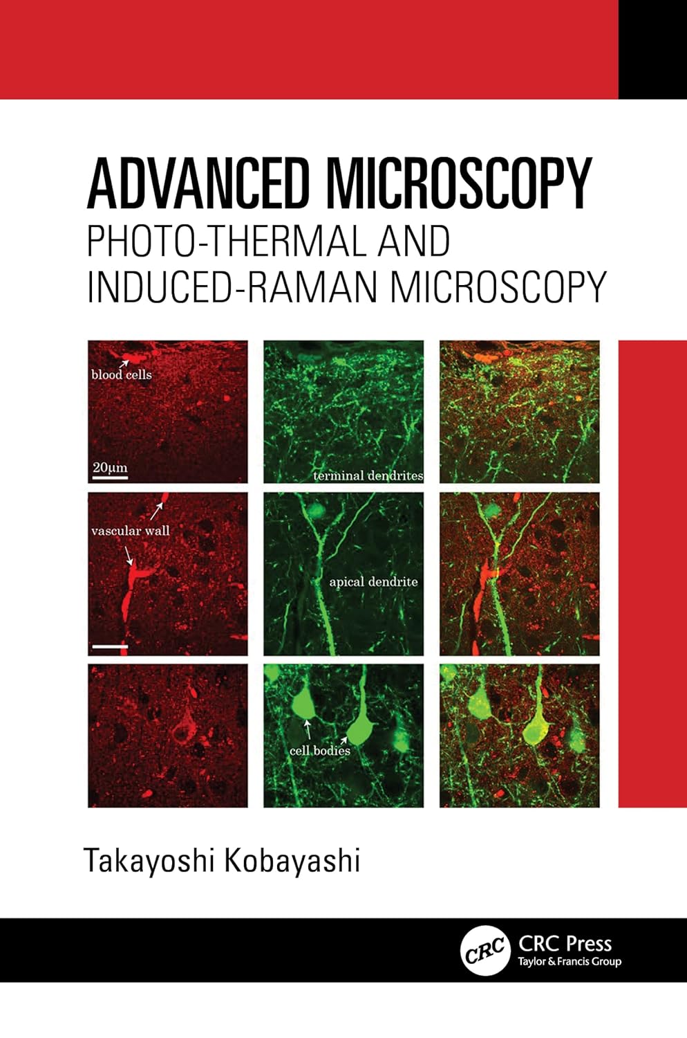 capítulo por capítulo baixar Advanced Microscopy: Photo-Thermal and Induced-Raman Microscopy (English Edition)