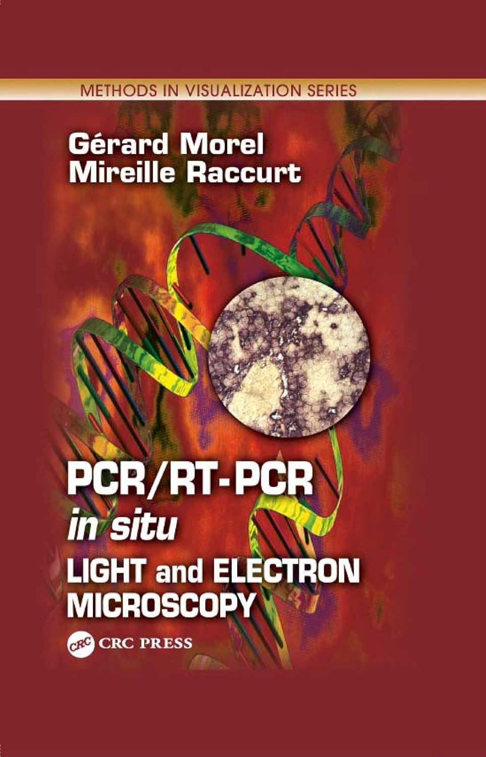ler totalmente PCR/RT- PCR in situ: Light and Electron Microscopy (Methods in Visualization) (English Edition)